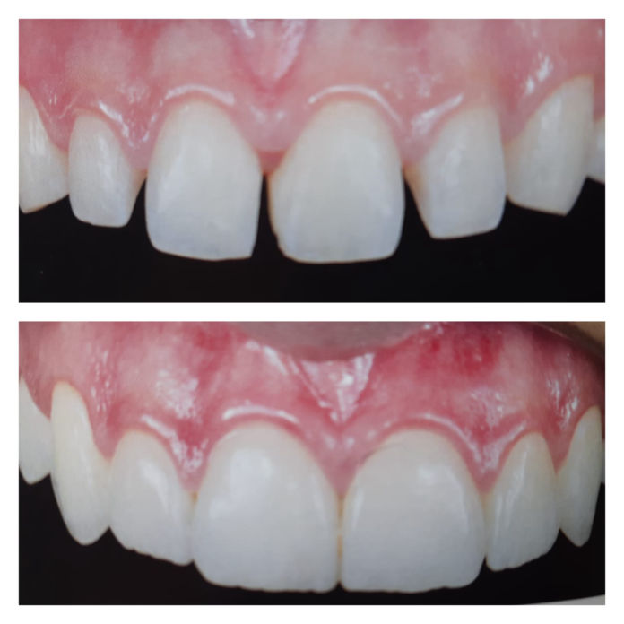 Dentista na Trindade