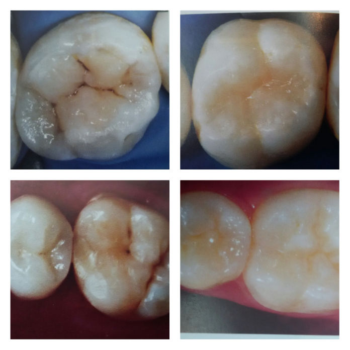 Dentista na Trindade